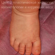 Центр пластической хирургии, косметологии и коррекции веса Клиника Века фото 1 на сайте Hamovniki.su