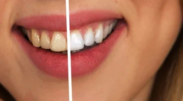 Студия косметического отбеливания зубов Вайт Смайл Плюс  на сайте Hamovniki.su