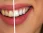 Студия косметического отбеливания зубов Вайт Смайл Плюс  на сайте Hamovniki.su