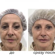Косметология GG Beauty clinic фото 6 на сайте Hamovniki.su
